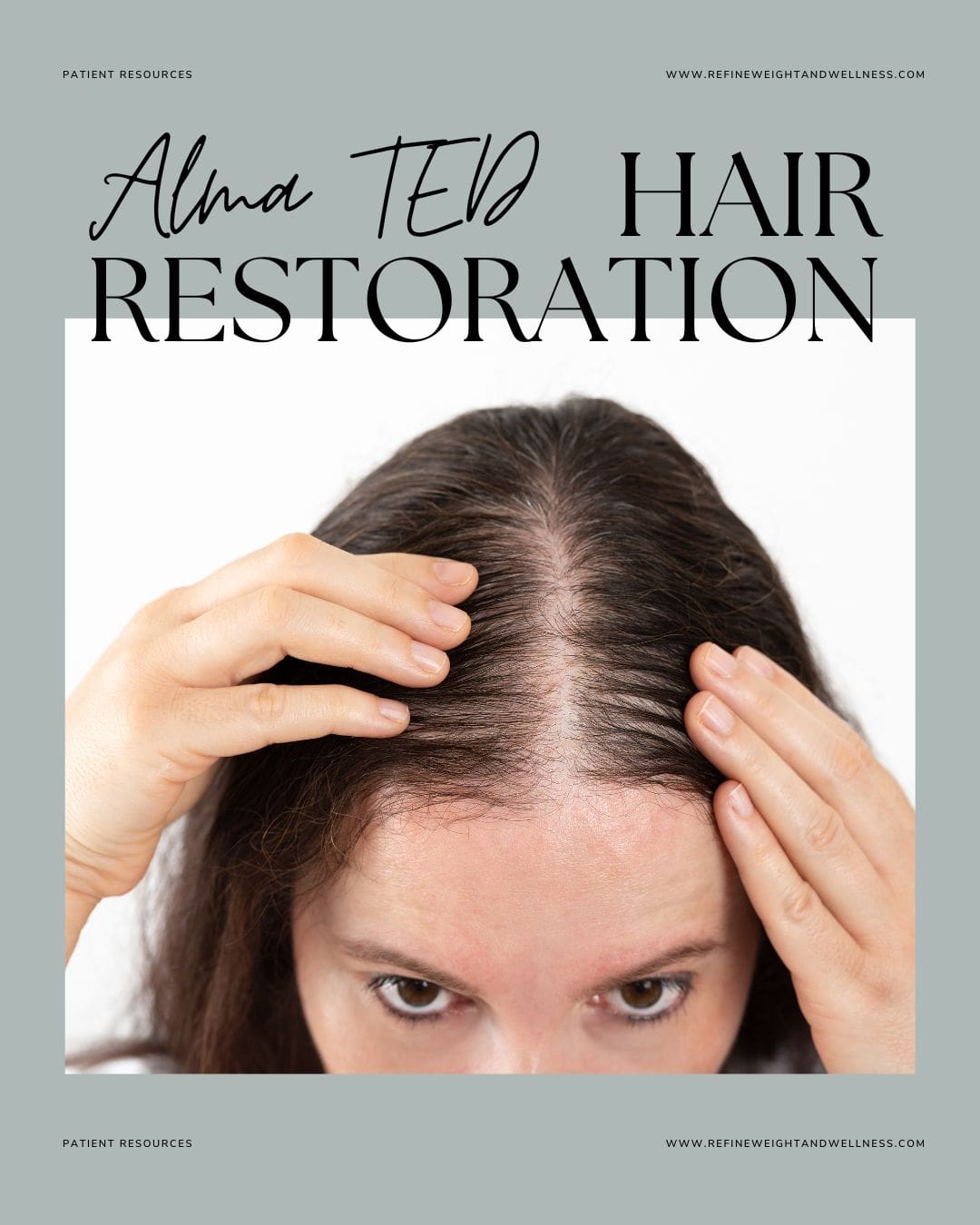 Alma TED Hair Restoration at Refine